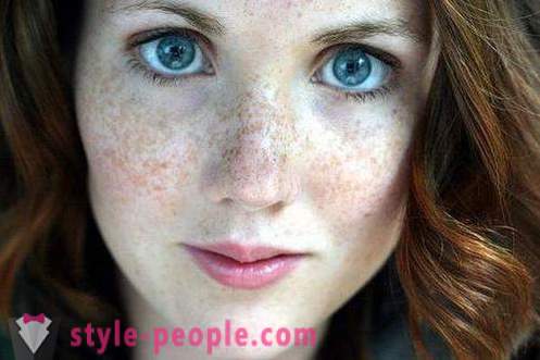 Kuidas vabaneda freckles? Parim koor ja folk õiguskaitsevahendeid freckles
