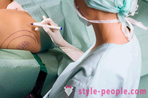 Plastiikkakirurgit hävitada stereotüübid oma tööd