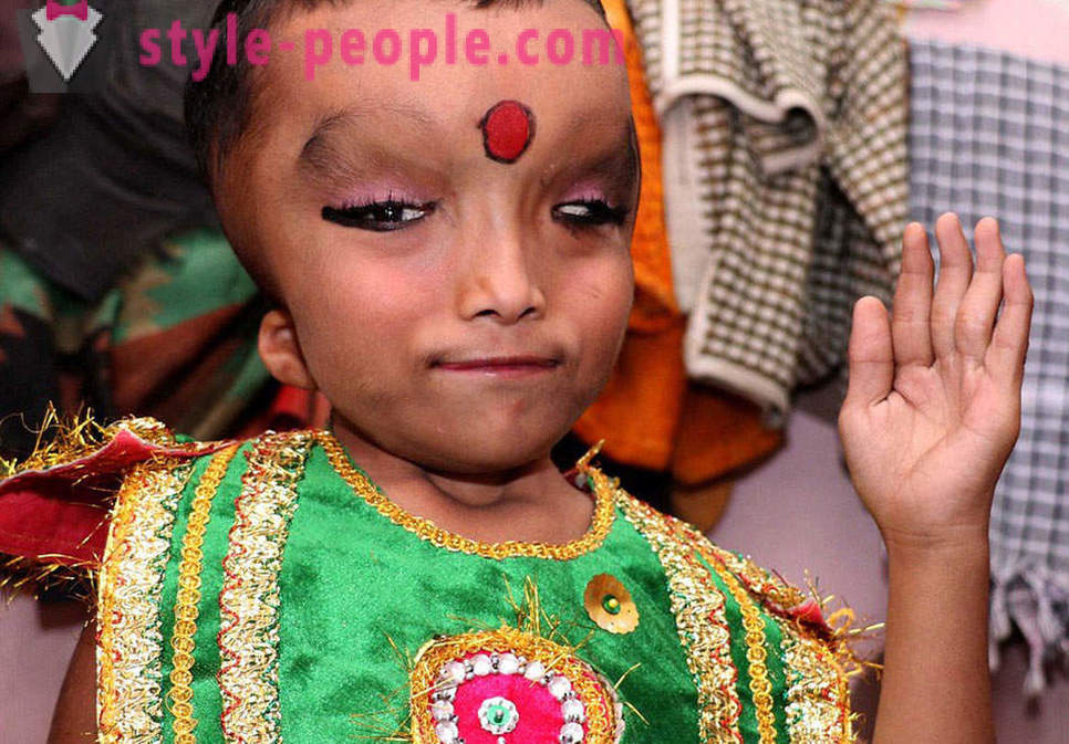 India küla jumalateenistuseks poiss deformeerunud pea jumal Ganesha