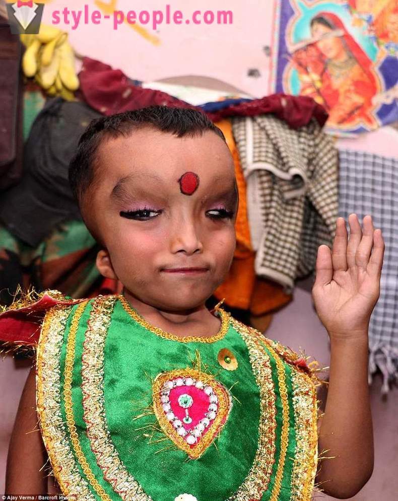 India küla jumalateenistuseks poiss deformeerunud pea jumal Ganesha