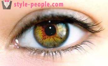 Swamp silmade värv. Mis määrab värvi inimsilmale?