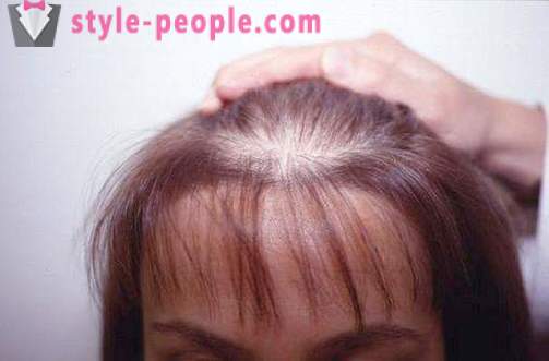 Darsonval juuksed. Application darsonvalya raviks ja ennetamiseks juuste